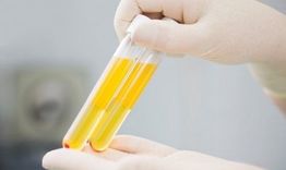 Община Шумен осигурява транспорт за желаещите да дарят кръвна плазма